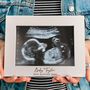 Personalised Baby Scan Photo Frame For Mum To Be, thumbnail 1 of 9