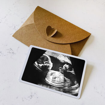 Personalised Baby Scan Wallet Metal Photo Cards, 8 of 8
