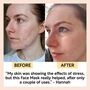 Vegan Cleansing Face Mask With Kaolin Clay For Redness And Hydration, thumbnail 4 of 10
