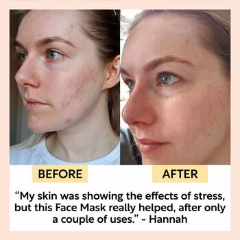 Vegan Cleansing Face Mask With Kaolin Clay For Redness And Hydration, 4 of 10