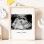 Baby Scan Ultrasound Print, thumbnail 2 of 7