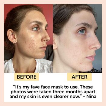 Vegan Cleansing Face Mask With Kaolin Clay For Redness And Hydration, 7 of 10