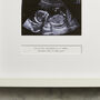 Personalised My First Baby Scan Frame, thumbnail 2 of 5