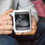 Personalised Baby Scan Mug, thumbnail 1 of 2