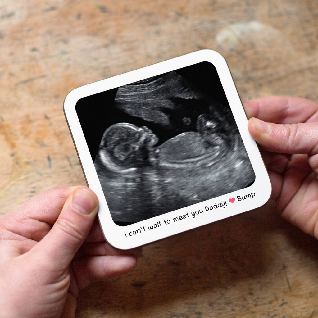 Personalised Baby Scan Coaster, 1 of 5