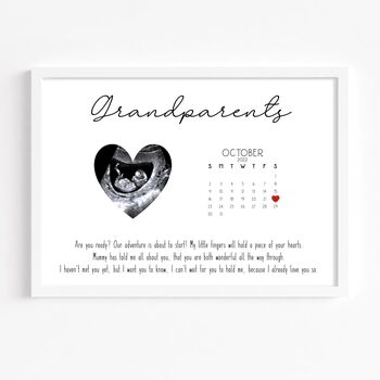 Pregnancy Announcement Print | Baby Ultrasound Scan Gift, 2 of 3