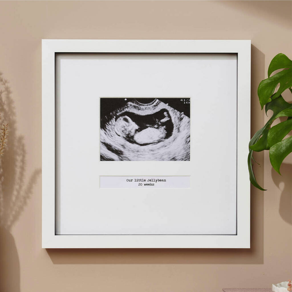 Personalised First Baby Scan Photo Frame, 1 of 5