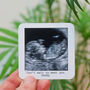 Father's Day Personalised Wallet Baby Scan Gift, thumbnail 1 of 3