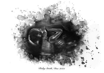Personalised Baby Ultrasound Scan Illustration Print, 6 of 6