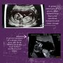 Personalised Metal Baby Ultrasound And Message Keyring, thumbnail 4 of 4