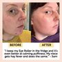 The Eye Cream + Eye Roller Duo, thumbnail 8 of 8