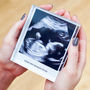 Personalised Baby Scan Acrylic Block, thumbnail 1 of 6