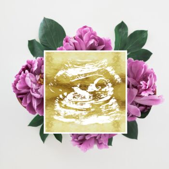 Personalised Pregnancy Ultrasound Foil Print, 2 of 5