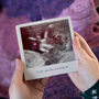 Personalised Mother's Day Scan Photo Tile For Mum To Be, thumbnail 1 of 5