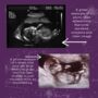 Personalised Baby Ultrasound Leather And Metal Keyring, thumbnail 4 of 4