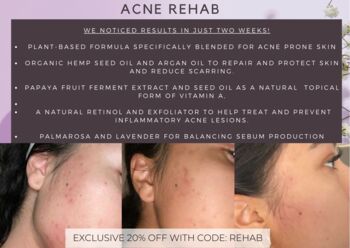 Argan Acne Rehab Serum 30ml | Plant Based Formula For Acne Prone Skin, 3 of 3
