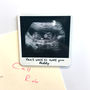 Personalised Baby Scan Magnet, thumbnail 3 of 6