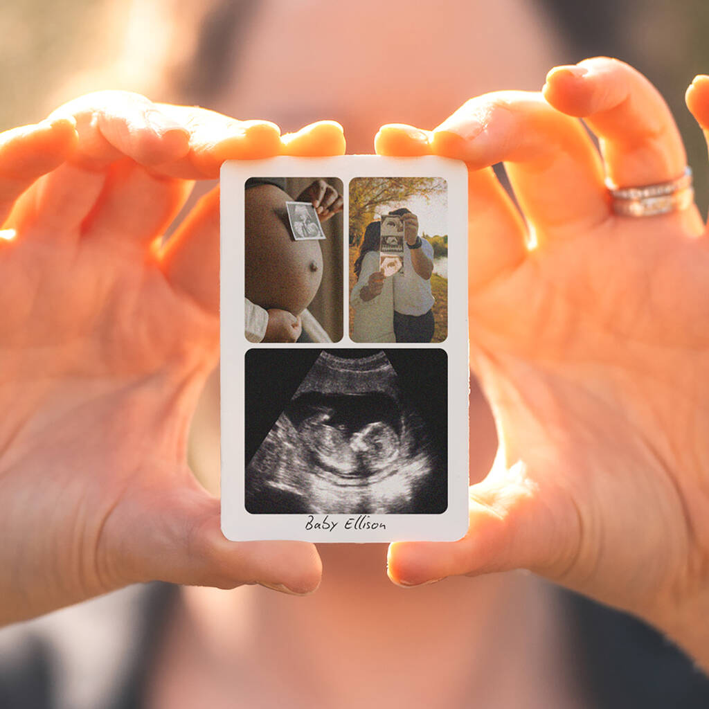 Personalised Three Photo And Message Baby Ultrasound Wallet Card, 1 of 2