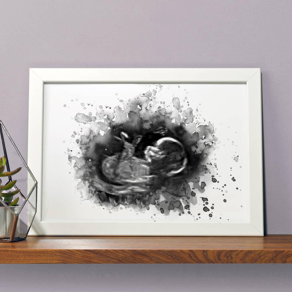 Personalised Baby Ultrasound Scan Illustration Print, 1 of 6