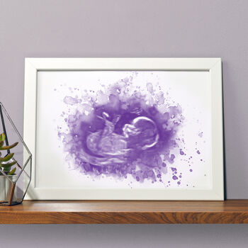 Personalised Baby Ultrasound Scan Illustration Print, 2 of 6